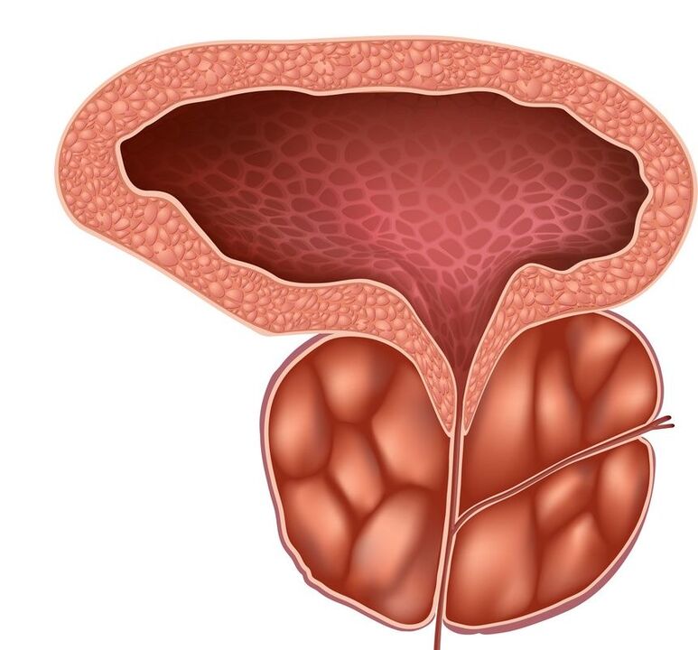 Gonflement de la prostate que la Prostaline peut gérer
